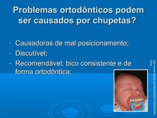 Problemas ortodônticos podemProblemas ortodônticos podem
ser causados por chupetas?ser causados por chupetas?
- Causadoras de mal posicionamento;Causadoras de mal posicionamento;
- Discutível;Discutível;
- Recomendável: bico consistente e deRecomendável: bico consistente e de
forma ortodôntica;forma ortodôntica;
http://www.zaroio.com.br/i/o/200710300250281
6.jpg
 