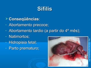 SífilisSífilis
 ConseqüênciasConseqüências::
- Abortamento precoce;Abortamento precoce;
- Abortamento tardio (a partir do 4º mês);Abortamento tardio (a partir do 4º mês);
- Natimortos;Natimortos;
- Hidropisia fetal;Hidropisia fetal;
- Parto prematuro;Parto prematuro;
http://iuhs-isa.org/blog/aborto.JPG
 