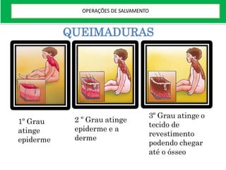 QUEIMADURAS
1º Grau
atinge
epiderme
2 º Grau atinge
epiderme e a
derme
3º Grau atinge o
tecido de
revestimento
podendo chegar
até o ósseo
OPERAÇÕES DE SALVAMENTO
 