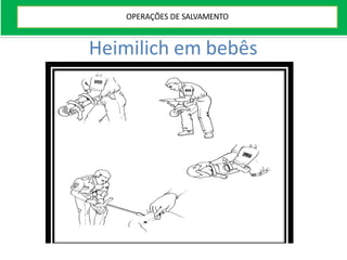 Heimilich em bebês
OPERAÇÕES DE SALVAMENTO
 