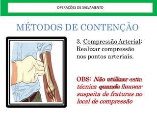 MÉTODOS DE CONTENÇÃO
3. Compressão Arterial:
Realizar compressão
nos pontos arteriais.
OBS: Não utilizar esta
técnica quando houver
suspeita de fraturas no
local de compressão
OPERAÇÕES DE SALVAMENTO
 