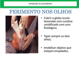 FERIMENTO NOS OLHOS
• Cobrir o globo ocular
lesionado com curativo
umidificado com soro
fisiológico;
• Tapar sempre os dois
olhos;
• Imobilizar objetos que
estejam empalados.
OPERAÇÕES DE SALVAMENTO
 