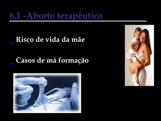 6.1 -Aborto terapêutico Risco de vida da mãe Casos de má formação  