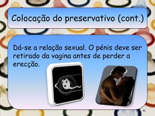 Colocação do preservativo (cont.)


Dá-se a relação sexual. O pénis deve ser
retirado da vagina antes de perder a
erecção.




                                           11
 