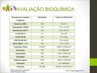 AVALIAÇÃO BIOQUÍMICA
 Hemograma Completo              Resultados   Valores de Referência
         15/08/2011
     Hemácias (RBC)                 4,56            4,0 a 5,3
   Hemoglobina (HGB)                12,0          11,5 a 14,5/dl
   Hematócrito (HCT)                33,2          33,0 a 43,0 %
       VCM (MCV)                    72               46 a 90
       CHM (MCH)                    26,3            25 a 31pg
     CHCM (MCHC)                    36             32 a 36 g/dl
   RDW (RDW – CV)                   13,0          11,5 a 15,0%
     Leucócitos Totais            13.800 ↑     4.000 a 12.000/mm³
         Bastonetes                 276           0 a 1000/mm3
       Segmentados                 1488         1.200 a 6.000/mm3
         Eosinófilos                552           0 a 700/mm3
     Linfócitos típicos            2070         1.000 a 5.500/mm3
         Monócitos                  414           0 a 1.000/mm3
         Plaquetas                307.000     150.000 a 450.000/mm3
Dados bioquímicos do paciente.
Fonte: Prontuário médico.
 