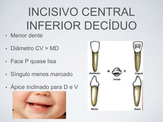 INCISIVO CENTRAL
INFERIOR DECÍDUO
• Menor dente
• Diâmetro CV > MD
• Face P quase lisa
• Síngulo menos marcado
• Ápice inclinado para D e V
 