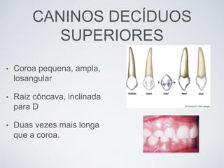 CANINOS DECÍDUOS
SUPERIORES
• Coroa pequena, ampla,
losangular
• Raiz côncava, inclinada
para D
• Duas vezes mais longa
que a coroa.
 