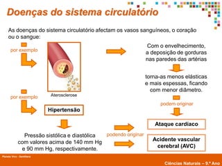 Doenças do sistema circulatório
     As doenças do sistema circulatório afectam os vasos sanguíneos, o coração
     ou o sangue:
                                                                 Com o envelhecimento,
       por exemplo
                                                                 a deposição de gorduras
                                                                 nas paredes das artérias


                                                                 torna-as menos elásticas
                                                                 e mais espessas, ficando
                                                                   com menor diâmetro.
                             Aterosclerose
       por exemplo
                                                                      podem originar
                            Hipertensão

                                                                    Ataque cardíaco

               Pressão sistólica e diastólica podendo originar
             com valores acima de 140 mm Hg                        Acidente vascular
              e 90 mm Hg, respectivamente.                          cerebral (AVC)
Planeta Vivo - Santillana
        Planeta Terra — 9.º ano
                                                                        Ciências Naturais – 9.º Ano
 