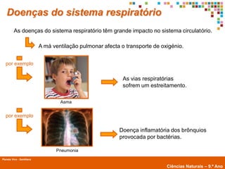 Doenças do sistema respiratório
          As doenças do sistema respiratório têm grande impacto no sistema circulatório.

                            A má ventilação pulmonar afecta o transporte de oxigénio.


   por exemplo


                                                             As vias respiratórias
                                                             sofrem um estreitamento.

                                    Asma


   por exemplo

                                                           Doença inflamatória dos brônquios
                                                           provocada por bactérias.

                                  Pneumonia
Planeta Vivo - Santillana
        Planeta Terra — 9.º ano
                                                                              Ciências Naturais – 9.º Ano
 