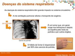 Doenças do sistema respiratório
          As doenças do sistema respiratório têm grande impacto no sistema circulatório.


                            A má ventilação pulmonar afecta o transporte de oxigénio.


    por exemplo
                                                                     É um tumor que, em geral,
                                                                     surge nos brônquios e depois
                                                                     se espalha pelo resto do
                                                                     pulmão e por outros órgãos.



                                   Cancro do pulmão


                                              O hábito de fumar é responsável
                                              por 90% dos cancros do pulmão.

Planeta Vivo - Santillana
        Planeta Terra — 9.º ano
                                                                                Ciências Naturais – 9.º Ano
 