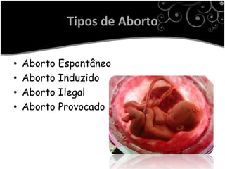 Tipos de Aborto

•   Aborto Espontâneo
•   Aborto Induzido
•   Aborto Ilegal
•   Aborto Provocado
 