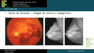 Instituto Federal do Ceará - IFCE
Campus Maracanaú
Ciência da Computação

Introdução
○

Áreas de Atuação - Imagem da retina e mamografia

Aldisio Medeiros
Tunay Araújo

Novembro, 08 de 2012

 