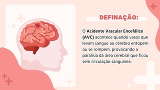 Apresentação Acidente Vascular Encefálico (AVC/AVE) | PDF