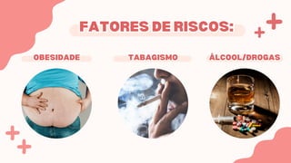 Apresentação Acidente Vascular Encefálico (AVC/AVE) | PDF