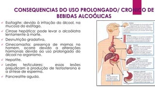 CONSEQUENCIAS DO USO PROLONGADO/ CRONICO DE
BEBIDAS ALCOÓLICAS
 Esofagite: devido à irritação do álcool, na
mucosa do esôfago.
 Cirrose hepática: pode levar o alcoólatra
lentamente à morte.
 Desnutrição gradativa.
 Ginecomastia: presença de mamas no
homem, ocorre devido a alterações
hormonais devido ao uso prolongado do
álcool no organismo.
 Hepatite.
 Lesões testiculares: essas lesões
prejudicam a produção de testosterona e
a síntese de esperma.
 Pancreatite aguda.
 