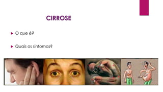 CIRROSE
 O que é?
 Quais os sintomas?
 