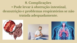 8. Complicações
• Pode levar à obstrução intestinal,
desnutrição e problemas respiratórios se não
tratada adequadamente.
 