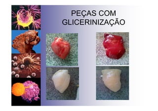 PEÇAS COM
GLICERINIZAÇÃO
 
