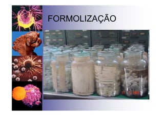 FORMOLIZAÇÃO
 