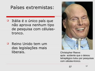 Países extremistas:

   Itália é o único país que
    não aprova nenhum tipo
    de pesquisa com células-
    tronco.

   Reino Unido tem um
    das legislações mais
    liberais.                   Christopher Reeve:
                                após acidente que o deixou
                                tetraplégico lutou por pesquisas
                                com células-tronco.

                                                        57
                                        57
 
