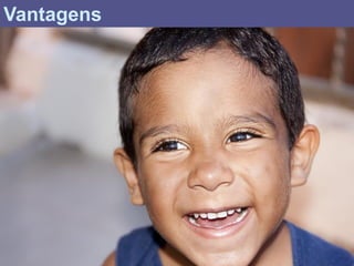Vantagens
 