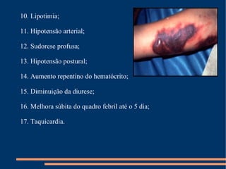 10. Lipotimia; 11. Hipotensão arterial; 12. Sudorese profusa; 13. Hipotensão postural; 14. Aumento repentino do hematócrito; 15. Diminuição da diurese; 16. Melhora súbita do quadro febril até o 5 dia; 17. Taquicardia. 