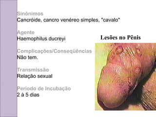 Sinônimos
Cancróide, cancro venéreo simples, "cavalo"
Agente
Haemophilus ducreyi
Complicações/Conseqüências
Não tem.
Transmissão
Relação sexual
Período de Incubação
2 à 5 dias
Lesões no Pênis
 