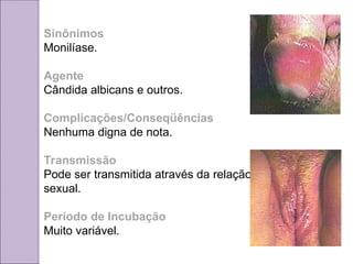 Sinônimos
Monilíase.
Agente
Cândida albicans e outros.
Complicações/Conseqüências
Nenhuma digna de nota.
Transmissão
Pode ser transmitida através da relação
sexual.
Período de Incubação
Muito variável.
 