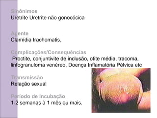 Sinônimos
Uretrite Uretrite não gonocócica
Agente
Clamídia trachomatis.
Complicações/Consequências
Proctite, conjuntivite de inclusão, otite média, tracoma,
linfogranuloma venéreo, Doença Inflamatória Pélvica etc
Transmissão
Relação sexual
Período de Incubação
1-2 semanas à 1 mês ou mais.
 