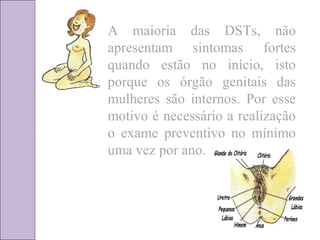 A maioria das DSTs, não 
apresentam sintomas fortes 
quando estão no início, isto 
porque os órgão genitais das 
mulheres são internos. Por esse 
motivo é necessário a realização 
o exame preventivo no mínimo 
uma vez por ano. 
 
