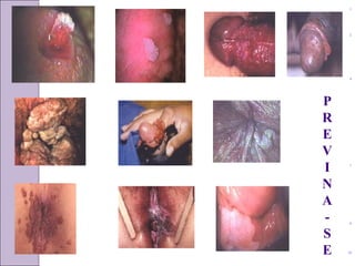 1 
2 
4 
7 
PREVINA-SE 
9 
10 
