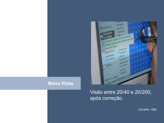 • ISDFUHDSIUHGDFHG




Baixa Visão
Click
              Visão entre 20/40 e 20/200,
              após correção.

                                   Carvalho, 1994
 