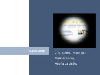 • ISDFUHDSIUHGDFHG




Baixa Visão
Click
              70% a 80% - visão útil.
              Visão Residual.
              Atrofia da visão.
 