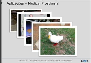 Aplicações – Medical Prosthesis

LWT Software Ltda. – Av. Kennedy, 164. 6o andar, São Bernardo do Campo SP – Cep: 09726-250, Fone: +55 (11) 3232-0532

 