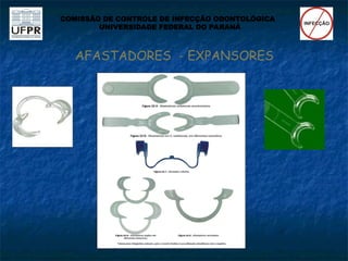 AFASTADORES - EXPANSORES
COMISSÃO DE CONTROLE DE INFECÇÃO ODONTOLÓGICA
UNIVERSIDADE FEDERAL DO PARANÁ
 