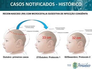 CASOS NOTIFICADOS - HISTÓRICO
RECEM-NASCIDO (RN) COM MICROCEFALIA SUGESTIVA DE INFECÇÃO CONGÊNITA
Outubro: primeiros casos 27/Outubro: Protocolo 1 02/Dezembro: Protocolo 2
33 cm 32 cm
 