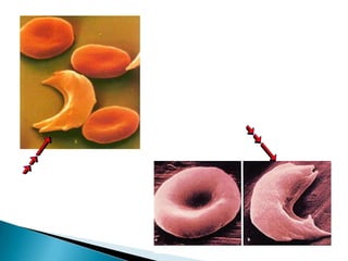 Poliploidia: esta mutação é letal para os humanos mas, em algumas plantas, é possível a formação de outras espécies através dela.Aneuploidias: quando existe mais um cromossomo, diz-se trissomia ou, monossomia quando falta um cromossomo. Também poderá surgir 4 ou mais cromossomos em vez de um par de cromossomos, polissomia esta, acontece raramente tal como a nulissomia que é a inexistência de cromossomos. 