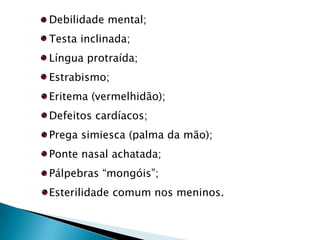 Sexo feminino;Ausência de corpúsculo de Barr;Baixa estatura;Ausência de mamas;Genitália infantil;Ausência de menstruação;Esterilidade;Pescoço alado;Deficiência mental;Alto índice de abortos.