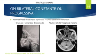  Acompanhada de secreção espessada = tumor obstrutivo retronasal
- Crianças: Hiperplasia de adenoide - Adultos: afastar neoplasia maligna
ON BILATERAL CONSTANTE OU
PROGRESSIVA
Tratado de Otorrinolaringologia da ABROL. 3ª Ed. Rio de Janeiro: Elsevier, 2018.
14
OBSTRUÇÃO NASAL
 