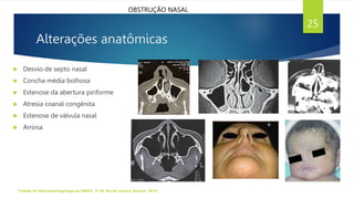 Alterações anatômicas
 Desvio de septo nasal
 Concha média bolhosa
 Estenose da abertura piriforme
 Atresia coanal congênita
 Estenose de válvula nasal
 Arrinia
Tratado de Otorrinolaringologia da ABROL. 3ª Ed. Rio de Janeiro: Elsevier, 2018.
25
OBSTRUÇÃO NASAL
 