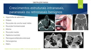 Crescimentos estruturais intranasais,
paranasais ou retronasais benignos
 Hipertrofia de adenoides
 Pólipos
 Mucoceles de concha nasal média
 Mucocele frontoetmoidal
 Glioma
 Mucocele maxilar
 Papiloma invertido
 Meningoencefalocele endonasal
 Hemangiomas
 MAV’s
Tratado de Otorrinolaringologia da ABROL. 3ª Ed. Rio de Janeiro: Elsevier, 2018.
26
OBSTRUÇÃO NASAL
 