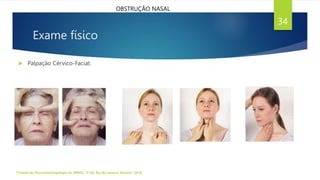 Exame físico
 Palpação Cérvico-Facial:
Tratado de Otorrinolaringologia da ABROL. 3ª Ed. Rio de Janeiro: Elsevier, 2018.
34
OBSTRUÇÃO NASAL
 