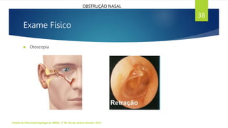 Exame Físico
 Otoscopia
Tratado de Otorrinolaringologia da ABROL. 3ª Ed. Rio de Janeiro: Elsevier, 2018.
38
OBSTRUÇÃO NASAL
 