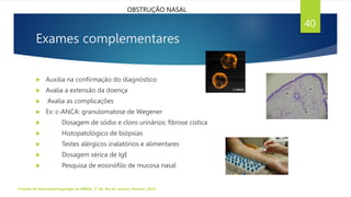 Exames complementares
 Auxilia na confirmação do diagnóstico
 Avalia a extensão da doença
 Avalia as complicações
 Ex: c-ANCA: granulomatose de Wegener
 Dosagem de sódio e cloro urinários: fibrose cística
 Histopatológico de biópsias
 Testes alérgicos inalatórios e alimentares
 Dosagem sérica de IgE
 Pesquisa de eosinófilo de mucosa nasal
Tratado de Otorrinolaringologia da ABROL. 3ª Ed. Rio de Janeiro: Elsevier, 2018.
40
OBSTRUÇÃO NASAL
 