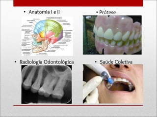 • Anatomia I e II • Prótese
Total
• Radiologia Odontológica • Saúde Coletiva
 