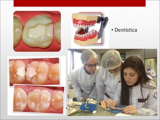 • Dentística
 