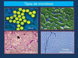 Tipos de micróbios
Vírus
Protozoários
Bactérias
Fungos
microscópios
 