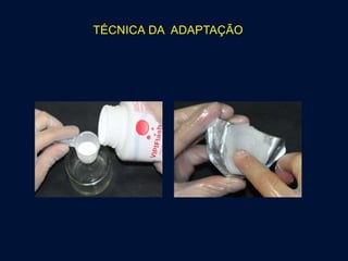 TÉCNICA DA ADAPTAÇÃO
 