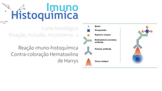 Imuno
Histoquímica
Corte histológico
(fixação, inclusão, microtomia...)
Reação imuno-histoquímica
Contra-coloração Hematoxilina
de Harrys
 