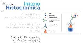 Imuno
Histoquímica
Corte histológico
(fixação, inclusão, microtomia...)
Reação imuno-histoquímica
Contra-coloração Hematoxilina
de Harrys
Finalização (Desidratação ,
clarificação, montagem)
 